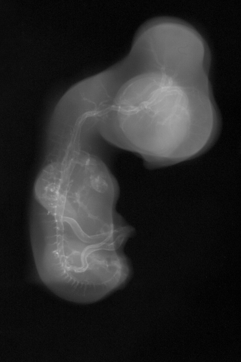 stage 29 chick embryo x-ray